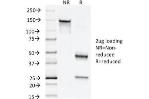 SDS-PAGE Analysis Purified Napsin A Mouse Monoclonal Antibody (NAPSA/1238).