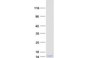 Validation with Western Blot