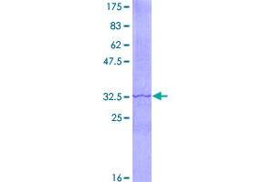 Image no. 1 for Adenylate Cyclase 6 (ADCY6) (AA 701-800) protein (GST tag) (ABIN1305956)