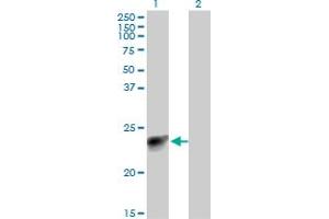 Western Blot analysis of MYL3 expression in transfected 293T cell line by MYL3 monoclonal antibody (M12), clone 4C2. (MYL3/CMLC1 anticorps  (AA 1-195))