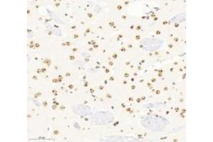 Immunohistochemistry analysis of paraffin-embedded mouse brain using,SETD2 (ABIN7075582) at dilution of 1: 3600 (SETD2 anticorps)