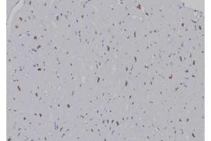 ABIN6277195 at 1/100 staining Human heart tissue by IHC-P. (Histone 3 anticorps  (H3K9me))