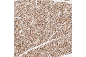 Immunohistochemical staining of human heart muscle with MAGED4B polyclonal antibody  shows strong membranous and cytoplasmic positivity in myocytes. (MAGED4B anticorps)