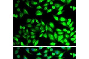 Immunofluorescence analysis of U2OS cells using PDIA6 Polyclonal Antibody