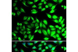 Immunofluorescence analysis of U2OS cells using PDIA6 Polyclonal Antibody (PDIA6 anticorps)
