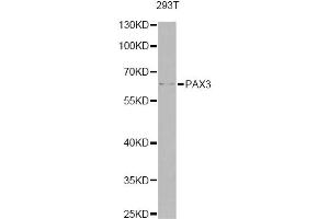 Western blot analysis of extracts of 293T cells, using PAX3 antibody (ABIN6290725) at 1:1000 dilution. (Paired Box 3 anticorps)