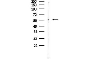 Western blot analysis of lysates from COLO205 cells, using MMP14 Antibody at 1/1000 dilution.