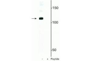 Western blot of mouse nuclei lysate showing specific immunolabeling of the ~120 kDa DGCR8 protein phosphorylated at in the first lane (-). (DGCR8 anticorps  (pSer377))