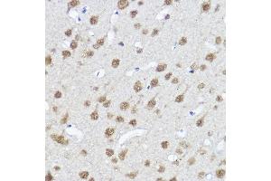 Immunohistochemistry of paraffin-embedded Rat brain using MYOCD antibody (ABIN7268730) at dilution of 1:100 (40x lens). (Myocardin anticorps  (AA 650-750))