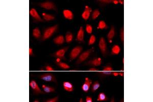 Immunofluorescence analysis of U2OS cells using EZH2 Polyclonal Antibody (EZH2 anticorps)