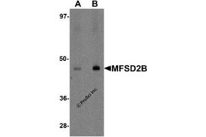 Western Blotting (WB) image for anti-Major Facilitator Superfamily Domain Containing 2B (MFSD2B) (Middle Region) antibody (ABIN1031004)