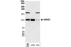 anti-DDHD Domain Containing 1 (DDHD1) (AA 50-100) antibody