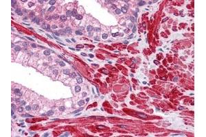 Human Prostate: Formalin-Fixed, Paraffin-Embedded (FFPE) (DPP8 anticorps)