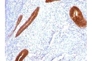 Image no. 3 for anti-Keratin 7 (KRT7) antibody (ABIN6170193) (Cytokeratin 7 anticorps)