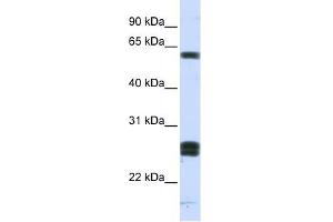 HABP2 antibody used at 1 ug/ml to detect target protein.