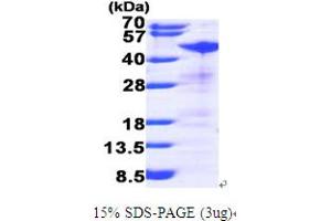SDS-PAGE (SDS) image for Ribonucleotide Reductase M2 (RRM2) (AA 1-389) protein (His tag) (ABIN667014)