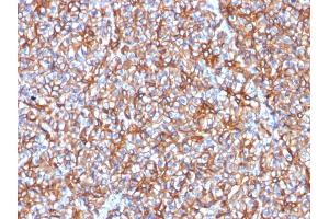 Formalin-fixed, paraffin-embedded human Pancreas stained with Spectrin beta III Mouse Monoclonal Antibody (SPTBN2/1778). (Spectrin, Beta, Non-erythrocytic 2 (SPTBN2) (AA 356-475) anticorps)