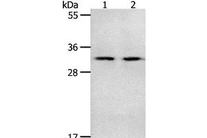 Western Blot analysis of Mouse spleen and intestinum crassum tissue using NME6 Polyclonal Antibody at dilution of 1:400 (NME6 anticorps)