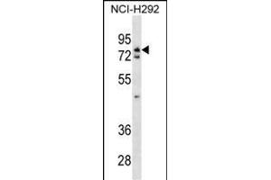 WRNIP1 Antibody (N-term) (ABIN1538893 and ABIN2838140) western blot analysis in NCI- cell line lysates (35 μg/lane). (WRNIP1 anticorps  (N-Term))