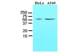 Cell lysates of HeLa and A549 (40 ug) were resolved by SDS-PAGE, transferred to nitrocellulose membrane and probed with anti-human kLF4 (1:1000). (KLF4 anticorps  (AA 1-170))