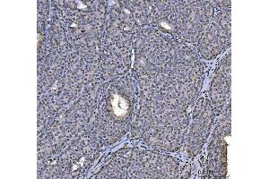 IHC analysis of hnRNP U/p120/HNRNPU using anti-hnRNP U/p120/HNRNPU antibody (ABIN7600979).