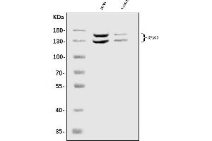 Western blot analysis of Astrin/Deepest/SPAG5 using anti-Astrin/Deepest/SPAG5 antibody (ABIN7602399).