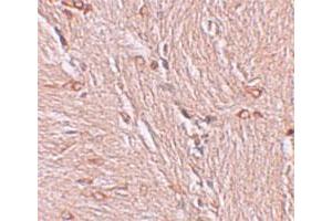 Immunohistochemical staining of human brain cells with ZBTB4 polyclonal antibody  at 2. (ZBTB4 anticorps  (C-Term))