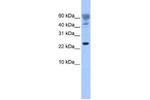 WB Suggested Anti-FUNDC1 Antibody Titration: 0. (FUNDC1 anticorps  (Middle Region))
