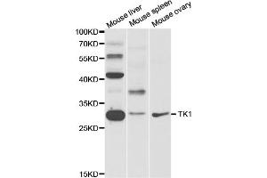 Western blot analysis of extracts of various cell lines, using TK1 antibody. (TK1 anticorps)