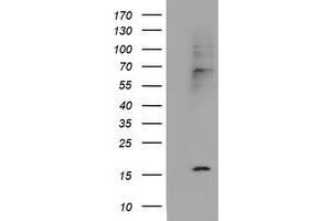 Image no. 5 for anti-Cystatin SA (CST2) antibody (ABIN1497759) (CST2 anticorps)