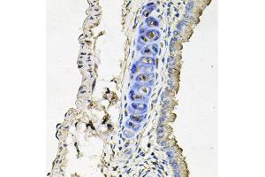 Immunohistochemistry of paraffin-embedded mouse lung using SLC39A4 antibody at dilution of 1:100 (x40 lens). (SLC39A4 anticorps)