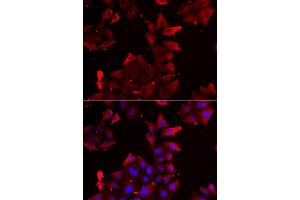 Immunofluorescence analysis of U2OS cell using PDLIM1 antibody. (PDLIM1 anticorps)