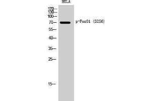 Western Blotting (WB) image for anti-Forkhead Box O1 (FOXO1) (pSer256) antibody (ABIN3172897) (FOXO1 anticorps  (pSer256))