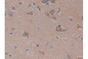 Detection of DKK3 in Human Brain Tissue using Polyclonal Antibody to Dickkopf Related Protein 3 (DKK3)