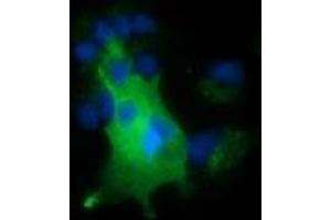 Anti-NUMB mouse monoclonal antibody (ABIN2453393) immunofluorescent staining of COS7 cells transiently transfected by pCMV6-ENTRY NUMB (RC216230). (NUMB anticorps)