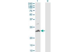 Western Blot analysis of TNFSF14 expression in transfected 293T cell line by TNFSF14 monoclonal antibody (M01), clone 4E3.