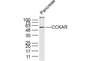 Lane 1: Mouse pancreas lysates probed with Anti CCKAR Polyclonal Antibody, Unconjugated (bs-11514R) at 1:300 overnight at 4˚C. (CCKAR anticorps  (AA 161-200))