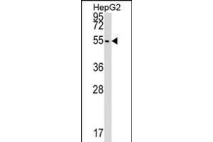 CLP1 Antibody (C-term) (ABIN1537107 and ABIN2848782) western blot analysis in HepG2 cell line lysates (35 μg/lane). (CLP1 anticorps  (C-Term))