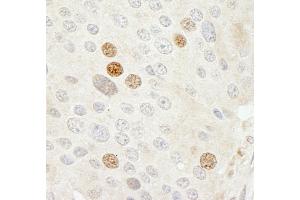 Immunohistochemistry (IHC) image for anti-Cyclin-Dependent Kinase 2 (CDK2) (AA 248-298) antibody (ABIN7448471)