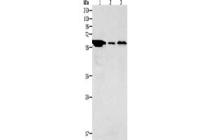 Gel: 10 % SDS-PAGE, Lysate: 40 μg, Lane 1-3: Hela cells, Mouse stomach tissue, Mouse brain tissue, Primary antibody: ABIN7189672(ADCYAP1R1 Antibody) at dilution 1/2000, Secondary antibody: Goat anti rabbit IgG at 1/8000 dilution, Exposure time: 5 minutes (ADCYAP1R1 anticorps)