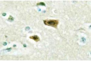 Immunohistochemistry (IHC) analyzes of LUCA15 antibody in paraffin-embedded human brain tissue. (RBM5 anticorps)