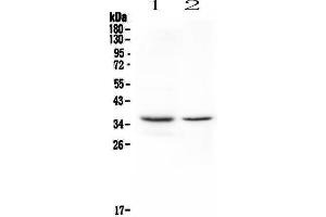 Western blot analysis of CD8 alpha using anti-CD8 alpha antibody . (CD8 alpha anticorps  (AA 28-196))