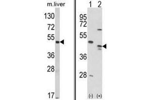 (LEFT) Western blot analysis of RAGE Antibody (Center) in mouse liver tissue lysates (35ug/lane). (RAGE anticorps  (Middle Region))
