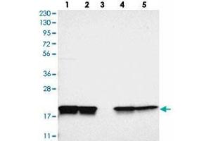 Western blot analysis of Lane 1: RT-4, Lane 2: U-251 MG, Lane 3: Human Plasma, Lane 4: Liver, Lane 5: Tonsil with PPIB polyclonal antibody .