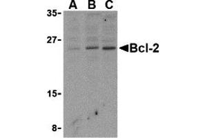 Western Blotting (WB) image for anti-B-Cell CLL/lymphoma 2 (BCL2) (N-Term) antibody (ABIN1031266) (Bcl-2 anticorps  (N-Term))