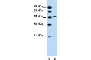 WB Suggested Anti-SLC10A5 Antibody Titration:  1. (SLC10A5 anticorps  (C-Term))
