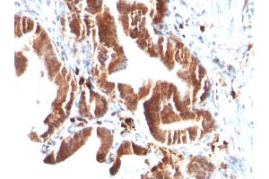 Formalin-fixed, paraffin-embedded human Gallbladder stained with Topo I, MT Mouse Monoclonal Antibody (TOP1MT/488). (TOP1MT anticorps)
