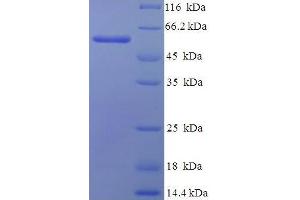 SDS-PAGE (SDS) image for Poly(A) Binding Protein, Cytoplasmic 1 (PABPC1) (AA 1-370), (partial) protein (His-SUMO Tag) (ABIN5710061)