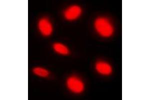 Immunofluorescent analysis of BAF250B staining in HeLa cells.