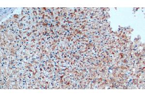 Detection of CTSD in Human Liver Tissue using Monoclonal Antibody to Cathepsin D (CTSD) (Cathepsin D anticorps  (AA 21-412))